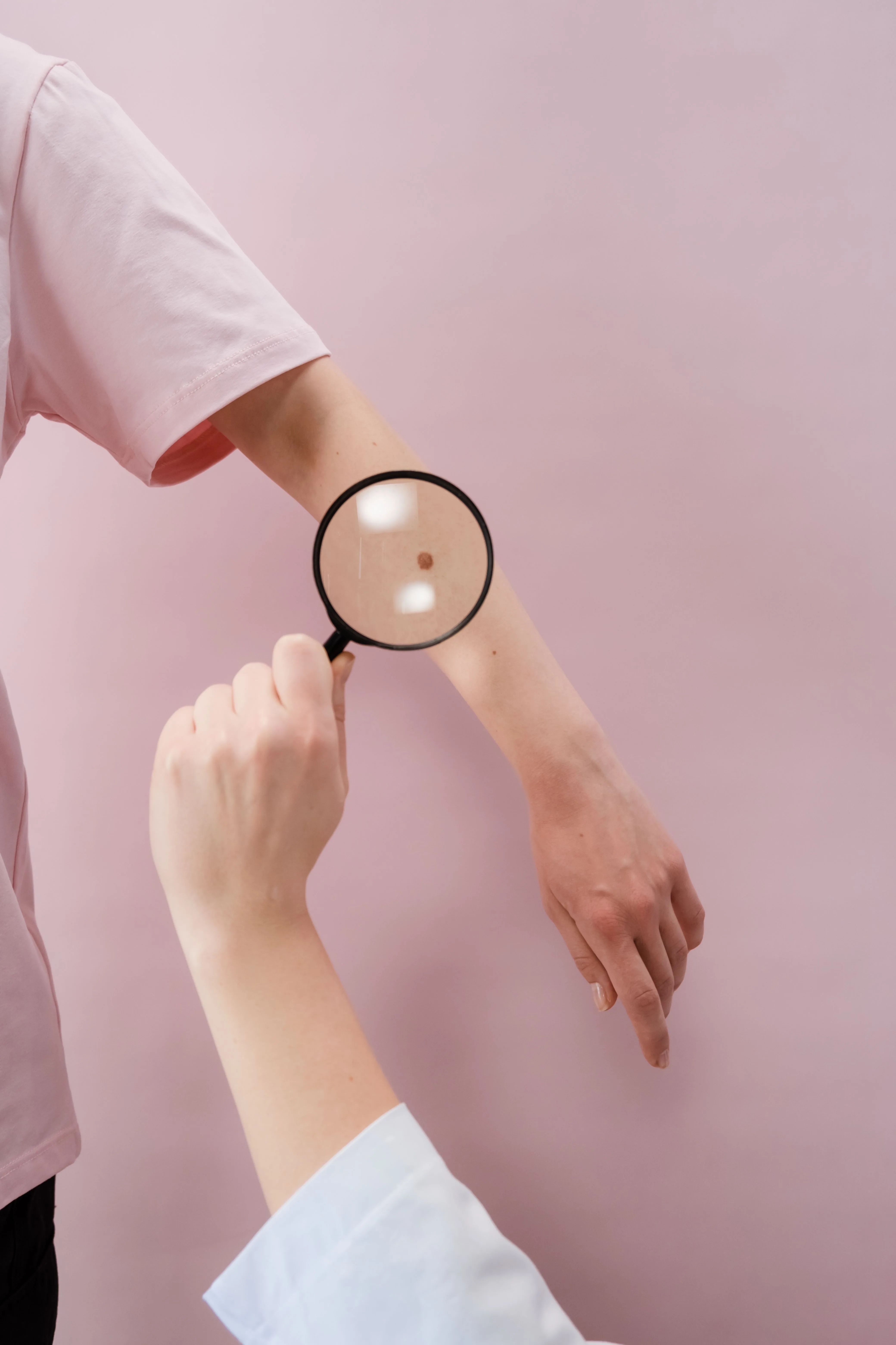 The best home remedy to treat blackheads